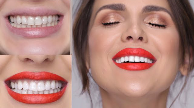 Go Smile Teeth Whitening Reviews - TeethWalls