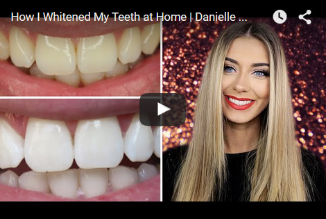 Teeth Whitening Reviews Best As Of February 21 Smile Brilliant