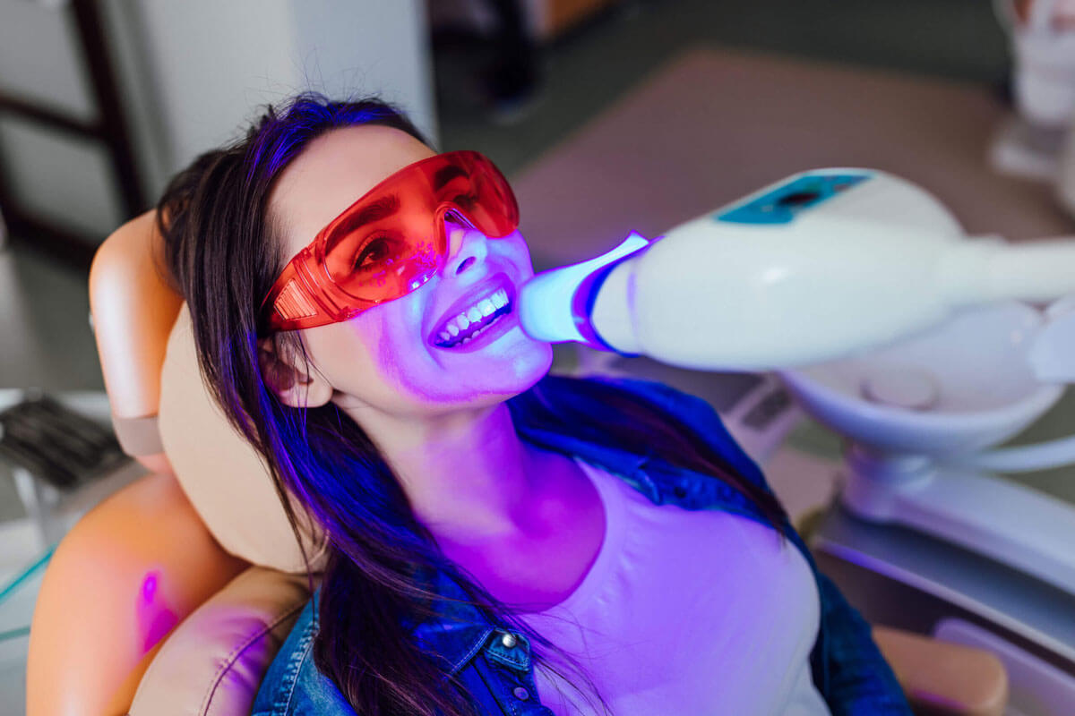 Laser Teeth Whitening Cost: How much and is it worth it? - Smile Brilliant