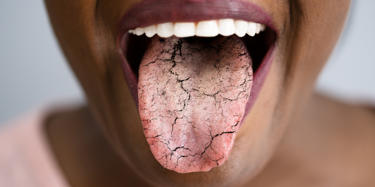 Foods That Help Dry Mouth A Journey to Oral Comfort and Wellness Foods That Help Dry Mouth A Journey to Oral Comfort and Wellness